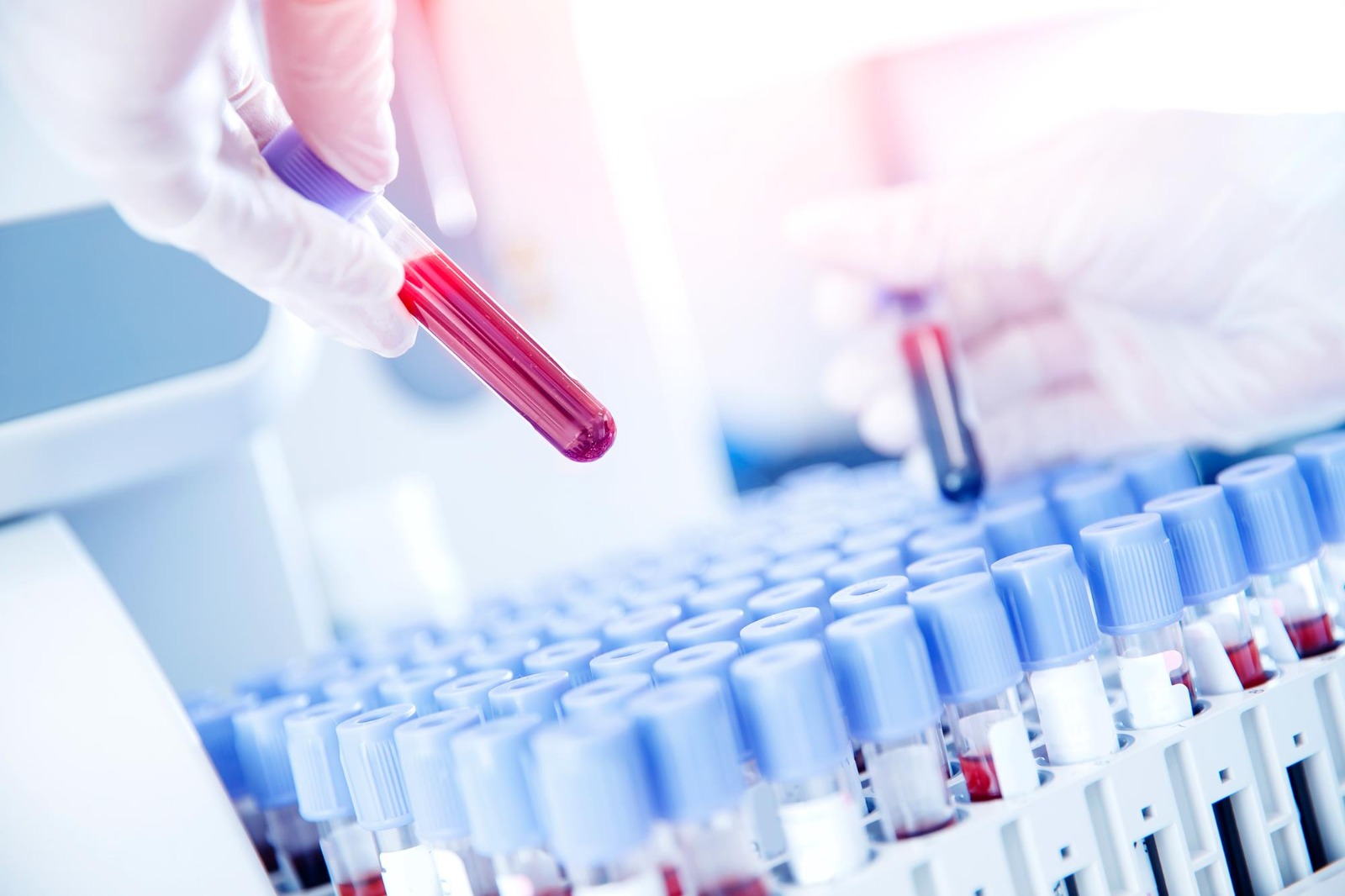LIMS Software: Modernes Datenmanagement fuer Labore